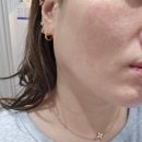 제림은탑맨션경로당 | 대구 시지 피부관리 올리제뷰티 하이푸 윤곽관리로 탄력 올리기