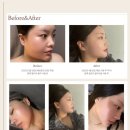 쎈언니뷰티 | 알록 울트라올라 홈케어 끝판왕 후기(쎈언니공구)
