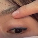 삼원약국 | 강남 수아미 아이라인 문신제거 내돈내산 1차 후기