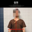 일이삼한의원 | [구로/신도림] 거북목 교정 신도림 체형교정마사지 신도림마사지 효과 후기
