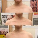 채움테라피 네이버블로그