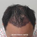 제이제이서연외과의원 네이버블로그