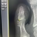 산곡정형외과의원 이미지