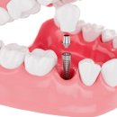 닥터배치과의원 이미지