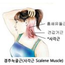 팔저림-사각근 이상 이미지