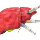 ‘침묵의 장기’ 간 건강 해치는 5가지 흔한 습관 이미지