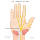 성누가외과의원 네이버블로그