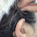 부천연세보청기 이미지