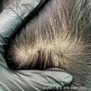 촘촘 스칼프 이미지