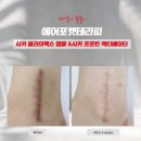 리셋테라피