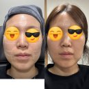 믿음사랑한의원 | [범계 한의원] 결혼 준비 중 찾아온 얼태기 극복...비너스주사 솔직 후기 (ft. 여신티켓, 안양사랑페이)