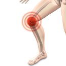 단월드 기체조로 튼튼한 허벅지 만들고 무릎관절염 예방하세요! 이미지