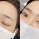 닥터브로우 이미지