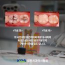 W화이트치과의원 네이버블로그