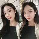 미사텐 | 하남미사 피부과 텐써마 레이저리프팅 솔직 후기