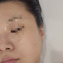 신촌역(2) | 신촌 에스테틱 수라움에스떼 신촌역 피부관리 후기