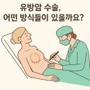 의료법인 제노플랜의료재단 나우누리요양병원 | 유방암 수술, 어떤 방식들이 있을까요?