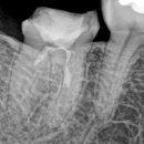 바른윤치과의원 이미지