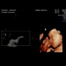 백일온누리약국 | 👶🏻[27W] 임신 26-27주차 증상 (봄빛병원 4D 입체초음파, 만삭사진 촬영 베이비파스텔 안양점, 닥터...