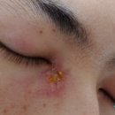 김도하내과의원 네이버블로그