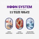 서초동 치과 김훈바른이치과교정과치과의원 진료시간 접근성 이용후기