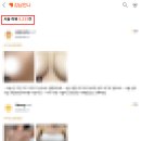 5231 | 짝가슴교정, 20년 가슴성형 연구한 의료진이 드리는 2가지 조언(논문 첨부)