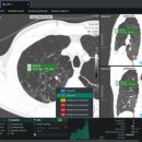 코어소프트 이미지