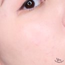 르베이스