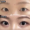 제이티성형외과의원 이미지