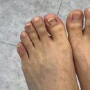 역곡신발 | 부천 역곡무좀발톱 관리 전문 페디프로 남편 발 관리해주기