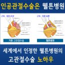 ((인공관절수술)) 고관절통증, 고관절수술, 고관절인공관절, 대퇴골두무혈성괴사 이미지