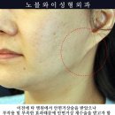 노블외과의원 네이버블로그