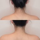 하곤법경로당 | 부평 에스테틱 유리햅에스떼 윤곽관리 후기 1:1 맞춤 프라이빗 진단