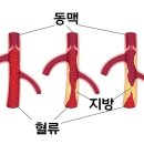 관상동맥 이란! 이미지