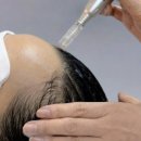 오직 스칼프 이미지