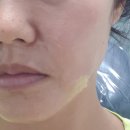 치우치과의원(상무점) 이미지