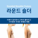 판교우리재활의학과의원 | 둥글게 말린 어깨, 라운드 숄더(Rounded Shoulder Posture, Forward Shoulder Porsture)