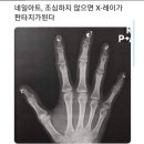 롬네일