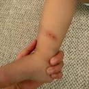 쥬쥬동물병원 | 안성 실내동물원 키즈카페 쥬쥬핑월드 안성점 솔직후기 ෆ 20개월 아기와 다녀온 후기ㅣ돼지코상처