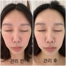 [부산 기장군 일광읍]미백+리프팅 즉각효과가 한번에? 기장일광마사지 김쌤스킨케어 방문후기