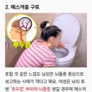뇌졸중 이미지