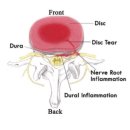 강서바른한의원 이미지