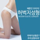 허벅지거상술 균형잡힌 하체 라인 완성! 이미지