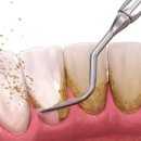 연세뉴욕치과의원 이미지