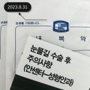 눈물길 실리콘삽입술 수술 후기