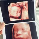 수정로 | 임신 28주차_성남 더미즈병원 입체초음파 후기&amp;비용 (무료 챗GPT 아기얼굴 예측)