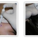 연세헤어성형외과의원 이미지