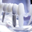 가능치과기공소 이미지