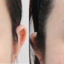 올케어성형외과의원 이미지