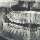 사랑니빠지는구강악안면외과치과의원 이미지